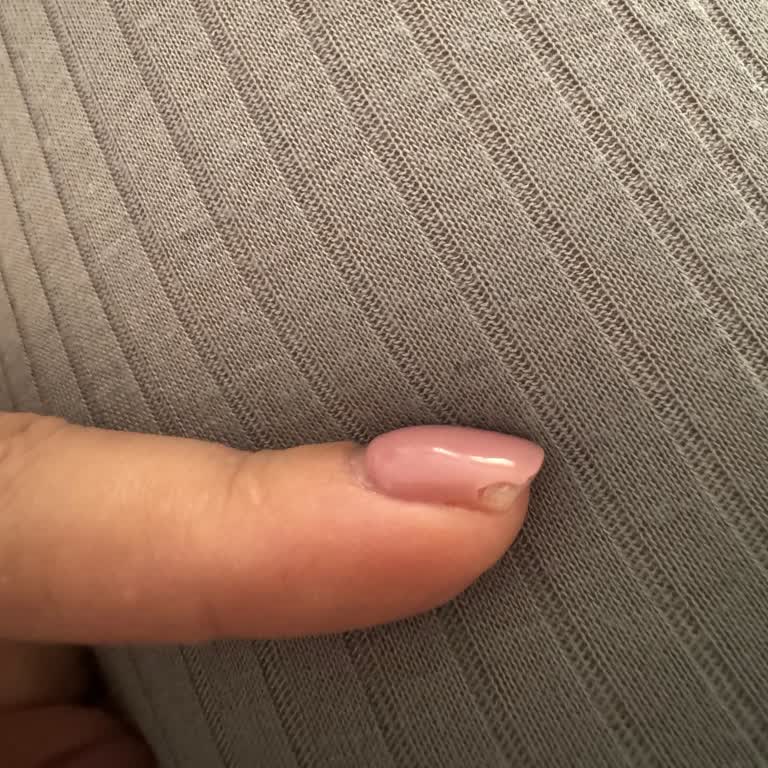 Ufuk Sürmelioğlu Tırnak Hizmetinde Yaşadığım Hayal Kırıklığı