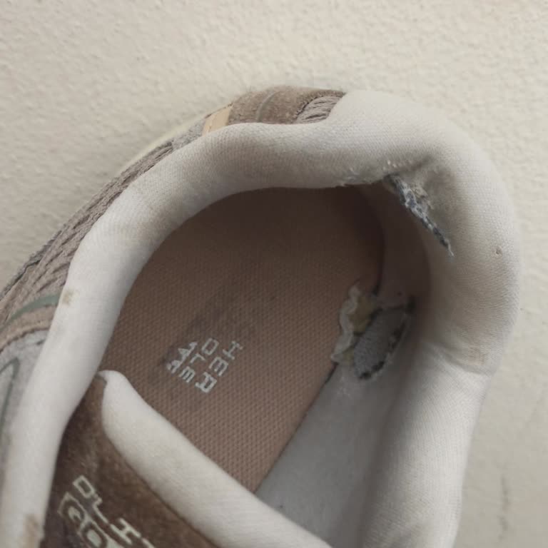 Skechers Ayakkabının Hızlı Deformasyonu Ve Müşteri Hizmetleri Sorunu