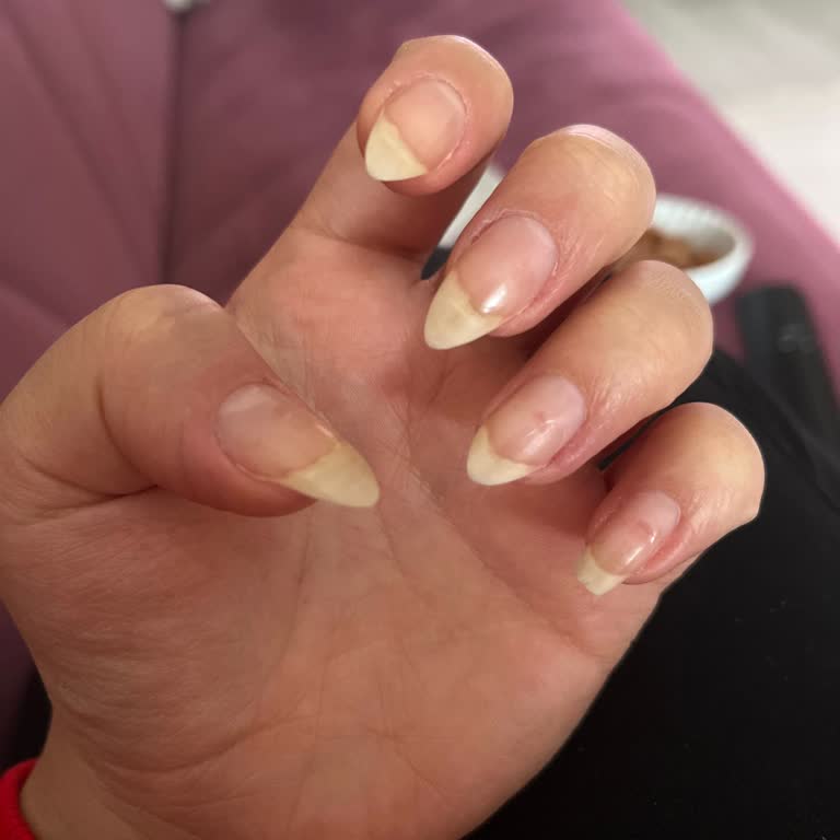 Suna Dumankaya Van Şubesinde Kötü Manikür Ve Pedikür Deneyimi!