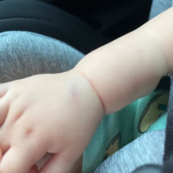 Akademi Hastanesi (Kocaeli) Yeni Doğanlarda Kan Alma Süreci