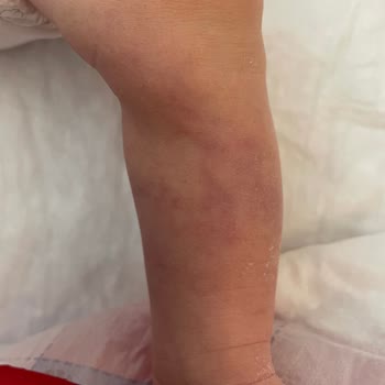 Medical Park Hastanesi Yenidoğan Yoğun Bakımda Yaşanan Ciddi İhmaller