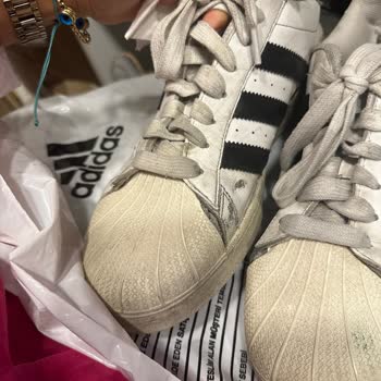 Adidas Ayakkabısının Arkasında Durmadı