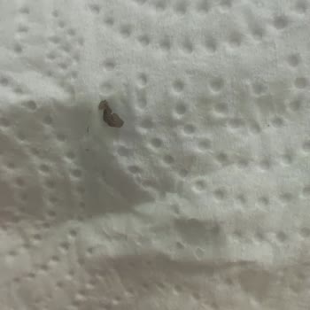 BİM Dost Marka Çocuk Devam Sütün De Yabancı Cisim Çıkması