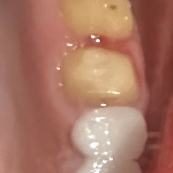 Clinic Ego Çok Kötü Hasta Bakımı