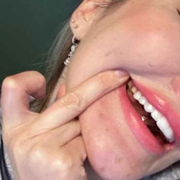 Clinic Ego Çok Kötü Hasta Bakımı