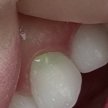 Clinic Ego Çok Kötü Hasta Bakımı