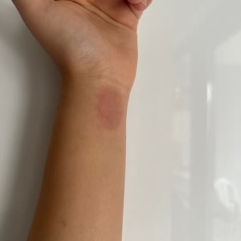 Apple Watch Kolumu Yaktı