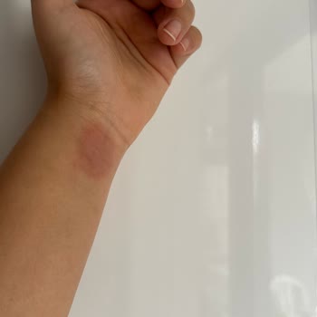 Apple Watch Kolumu Yaktı