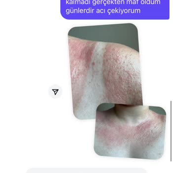 Nivea Sorumsuzluğu Ve Kalitesizliği