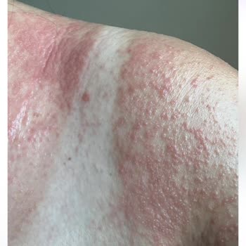 Nivea Sorumsuzluğu Ve Kalitesizliği