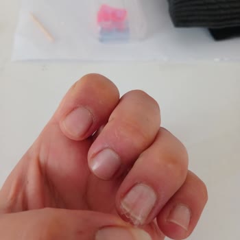 Gratis Nascita Tırnak Yapıştırıcısının Kullanım Sorunu