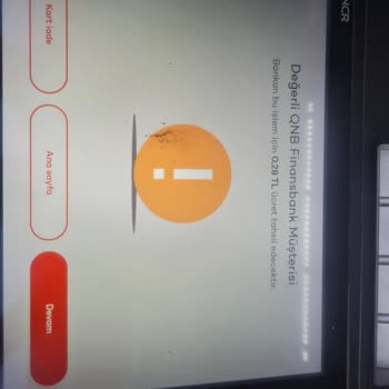 Akbank Ve QNB Hizmet Anlayışı