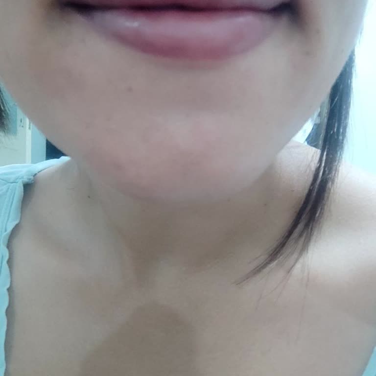 Rosso Sefaköy Kötü Dudak Dolgusu