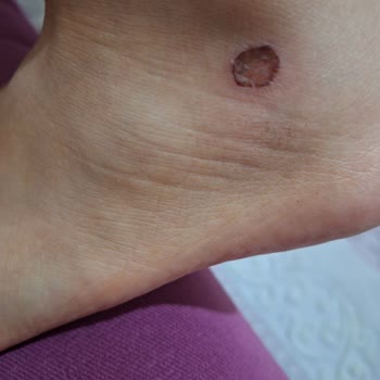 Pumadan Aldığım Ayakkabı Ayağımı Vurmasına Rağmen Kabul Edilmedi