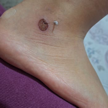 Pumadan Aldığım Ayakkabı Ayağımı Vurmasına Rağmen Kabul Edilmedi