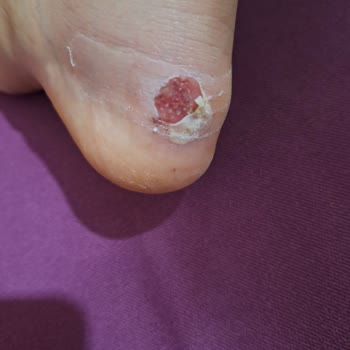 Pumadan Aldığım Ayakkabı Ayağımı Vurmasına Rağmen Kabul Edilmedi