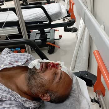 Sanko Üniversitesi Hastanesi Pansuman Odasında Göz Ve Çeneme Dikiş Atıldı Enfeksiyon Oldu Bu .