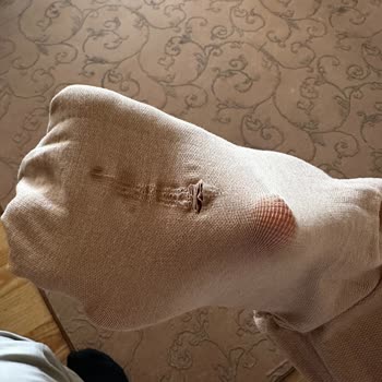 İlk Kullanımda Kaçan Sigvaris Çorabın Değişimini İstiyorum