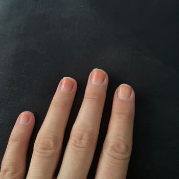 Flormar Oje Turuncu Leke Yaptı