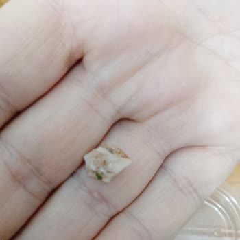 Yemeksepeti Nakkaş Kebap Sipariş Sonrası Dişim Kırıldı