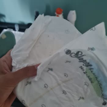 Sleepy Bionatural Bebek Bezinde Küf Benzeri Oluşumlar