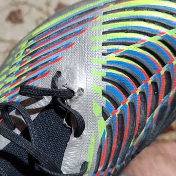 Adidas Predator Edge Krampon Diş Kırılması Ve Patlaması