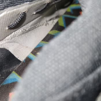 Adidas Predator Edge Krampon Diş Kırılması Ve Patlaması