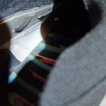 Adidas Predator Edge Krampon Diş Kırılması Ve Patlaması