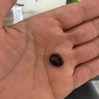 Mini Cheetos Shots Cipsten Yabancı Madde Çıkması