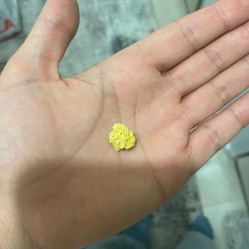 Mini Cheetos Shots Cipsten Yabancı Madde Çıkması