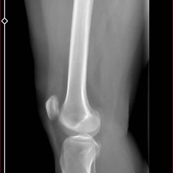 Obilet Ve Sunexpress Beni Oyalıyor, Paramı Geri Alamıyorum