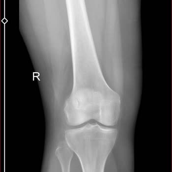 Obilet Ve Sunexpress Beni Oyalıyor, Paramı Geri Alamıyorum