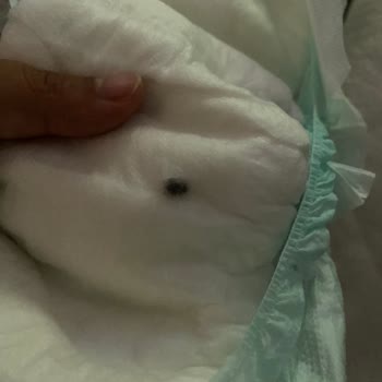 Ebebek Bebek Bezi İçerisinde Yabancı Bir Cisim Var
