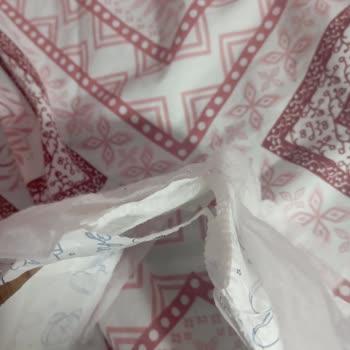 Molped Üretim Hataları 3.