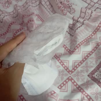 Molped Üretim Hataları 3.