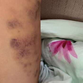 Eyşan Beauty Eksik Kalan Paketim