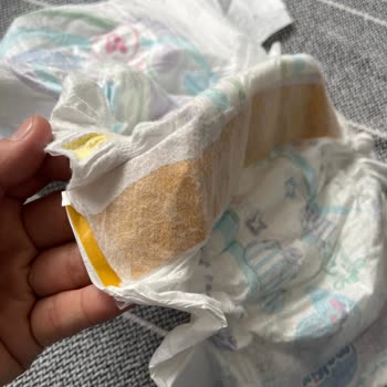 Molfix Hatalı Bez Çıktı