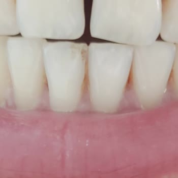 Avrupadent Buca Şirinyer Şubesinde Yaşanan Diş Tedavisi Sorunu