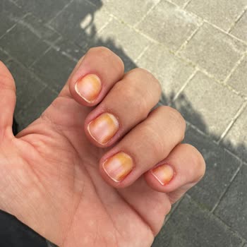 Flormar Jelly Look Serisi Oje Tırnakları Turunculaştırıyor