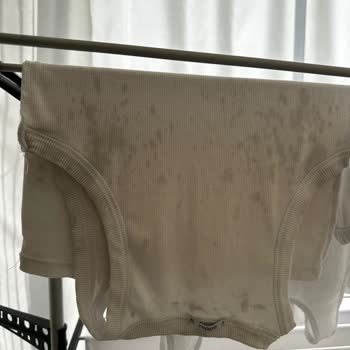 Siemens Çamaşır Makinesi Sürekli Leke Yapıyor Ve Sorun Çözülemiyor