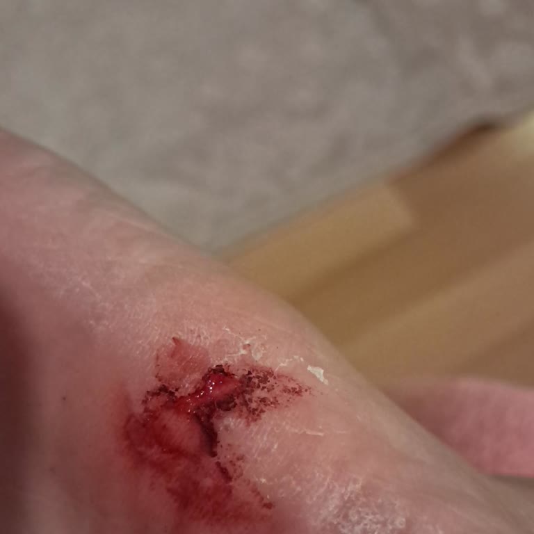 Bamboo Avm Nox Shoes Mağazası (babetten Tel Çıkması)