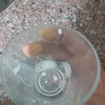 Torku Yabancı Cisim Çıktı