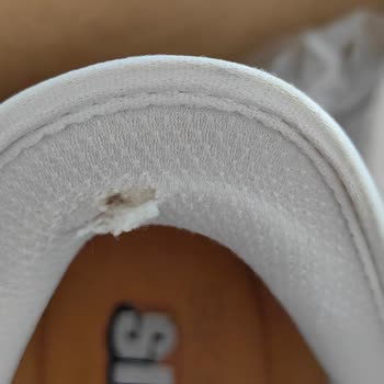 Skechers Ayakkabı Kısa Sürede Deforme Olması, Olka'nın Desteksizliği