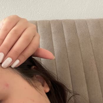 Yves Rocher Yüz Temizleme Jeli Sivilce Problemi