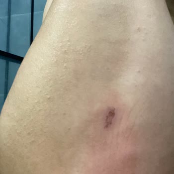 Arlina Estetik Çok Pişmanım Memnun Kalmadım