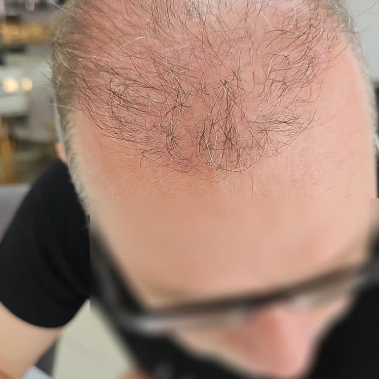 Acıbadem Hastanesi Acıbadem Saç Ekim Merkezi