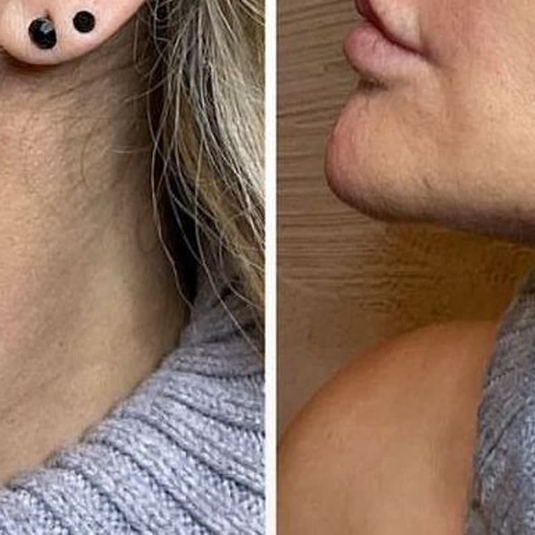 Estpoint Doktorun Kendi Önerilerini Zorla Uygulaması