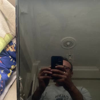 Onvo TV'de Ekran Çatlağı Ve Yanık Sorunu