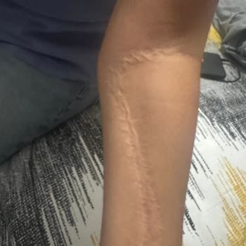 Konya Hospital Kızımın Tedavisinde Yaşadığımız Büyük Sorunlar