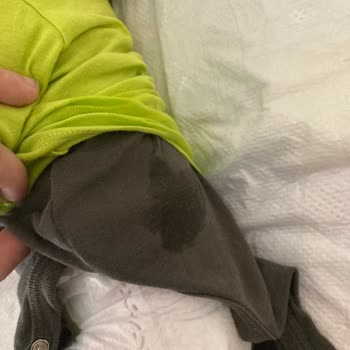 Prima Sızdırma Problemi Lütfen Çözüm İstiyorum